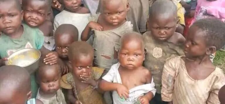 Uvira face à l’urgence nutritionnelle : La malnutrition progresse, l’alerte est lancée