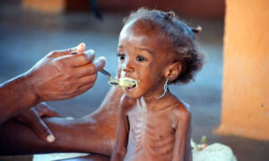 Sud-Kivu : à Kiliba, la malnutrition infantile prend une ampleur inquiétante